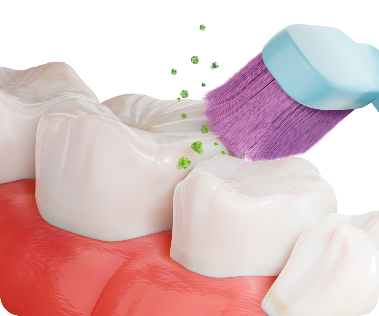 Профессиональная гигиена помогает предотвратить развитие кариеса, пародонтита и других заболеваний полости рта, которые могут привести к потере зубов.<br>
 <br>
Помните, что регулярное посещение стоматолога для профессиональной гигиены является одним из важнейших шагов в поддержании здоровья зубов и десен. Не откладывайте поход к стоматологу на потом — заботьтесь о своем здоровье прямо сейчас!