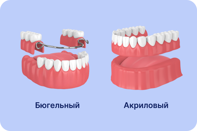 Протезирование зубов в сети клиник George Group — это ваша возможность обрести идеальную улыбку быстро и легко. Мы используем инновационные методики, благодаря которым коронки и виниры выглядят так же естественно, как настоящие зубы.<br>
 <br>
Наша собственная зуботехническая лаборатория позволяет создать протез, который подходит пациентам с ювелирной точностью. Цифровая реставрация CEREC позволяет провести реставрацию всего за один визит к стоматологу!