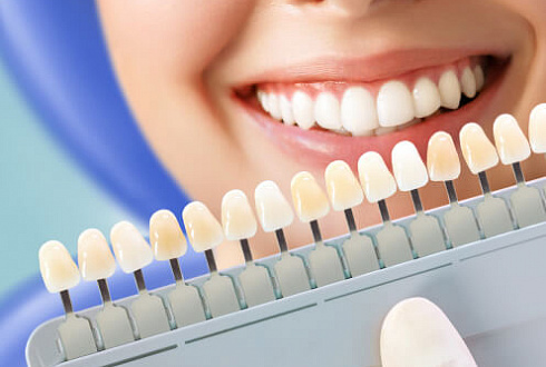 Какие факторы влияют на изменение цвета зубов?